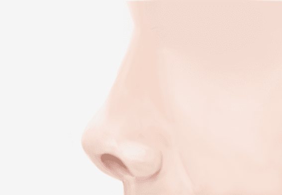 짧은 코(들창코) 옆모습 그림