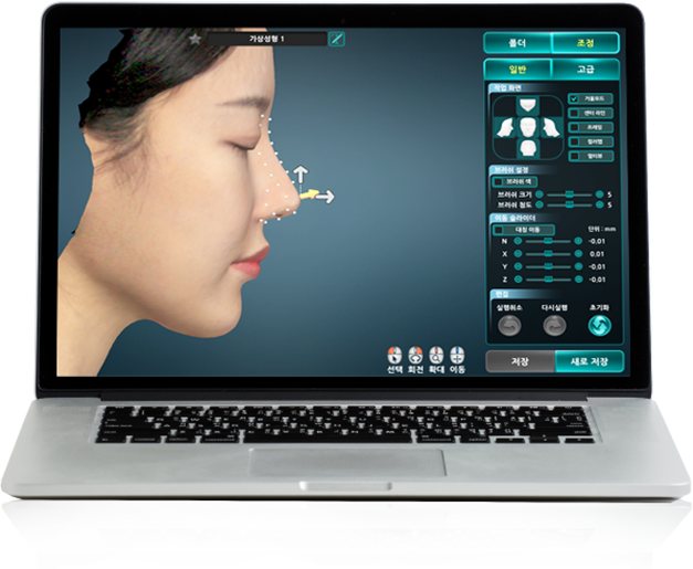 3D 가상성형 소프트웨어 화면(옆얼굴 코 라인 조정)을 띄운 노트북